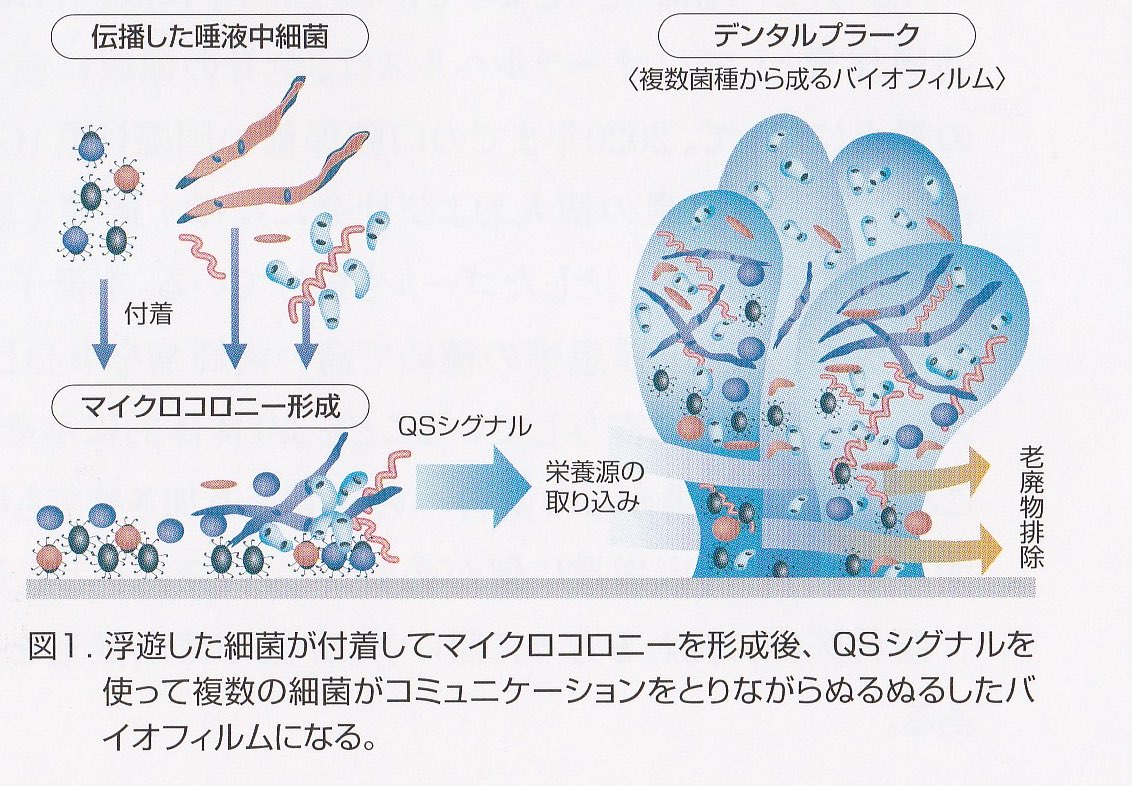 歯周病は薬では治らない理由